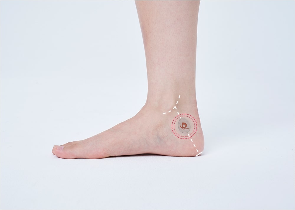 足底腱膜炎 の改善に効果的なツボの位置 ファイテン株式会社 Phiten